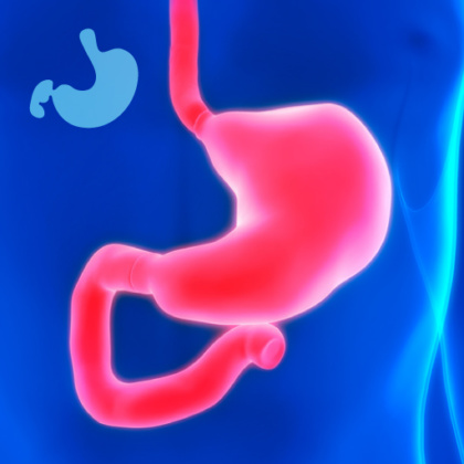 Leczenie przełyku Barretta, Gastromed, na zdjęciu: czerwony żołądek