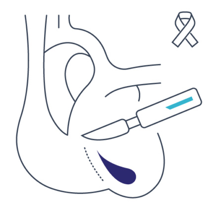 Chirurgia onkologiczna Lublin, Gastromed Lublin, Grupa Scanmed, piktogram przedstawiający skalpel
