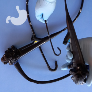 Dłonie lekarza i gastroskop, Gastroskopia przeznosowa Lublin, Gastromed Lublin, Grupa Scanmed