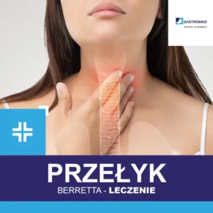 Przełyk Berretta - leczenie, na zdjęciu szyja kobiety, Gastromed, Scanmed