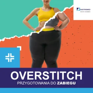 OverStitch - przygotowania do zabiegu, kolaż zdjęć, szczupłej osoby i osoby z nadwagą, ZOZ Gastromed Lublin, Grupa Scanmed