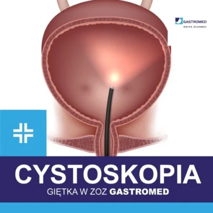 Cystoskopia giętka Lublin, w Gastromedzie Lublin, Grupa Scanmed, cystoskop oraz pęcherz