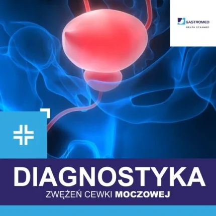 Diagnostyka zwężeń cewki moczowej, Gastromed, Scanmed, zdjęcie pęcherza