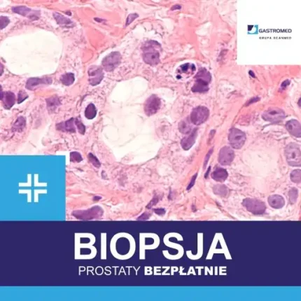 Biopsja prostaty Lublin, Gastromed Lublin, Scanmed, na zdjęciu komórki widoczne pod mikroskopem