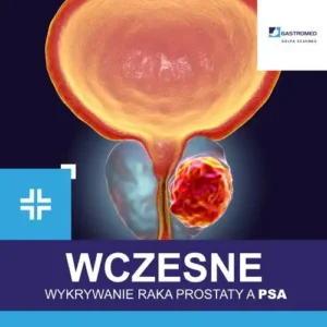 Wczesne wykrywanie raka prostaty a PSA, ZOZ Gastromed Lublin, Grupa Scanmed, grafika ukazująca nowotwór stercza