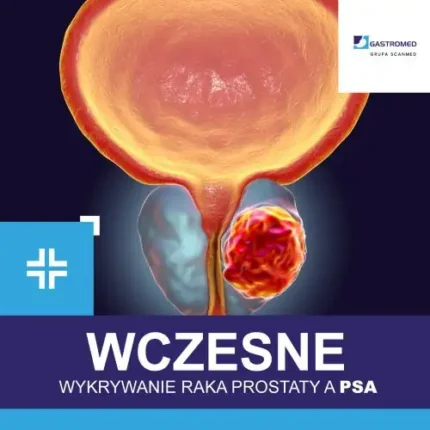 Wczesne wykrywanie raka prostaty a PSA, Gastromed, Scanmed, nowotwór stercza